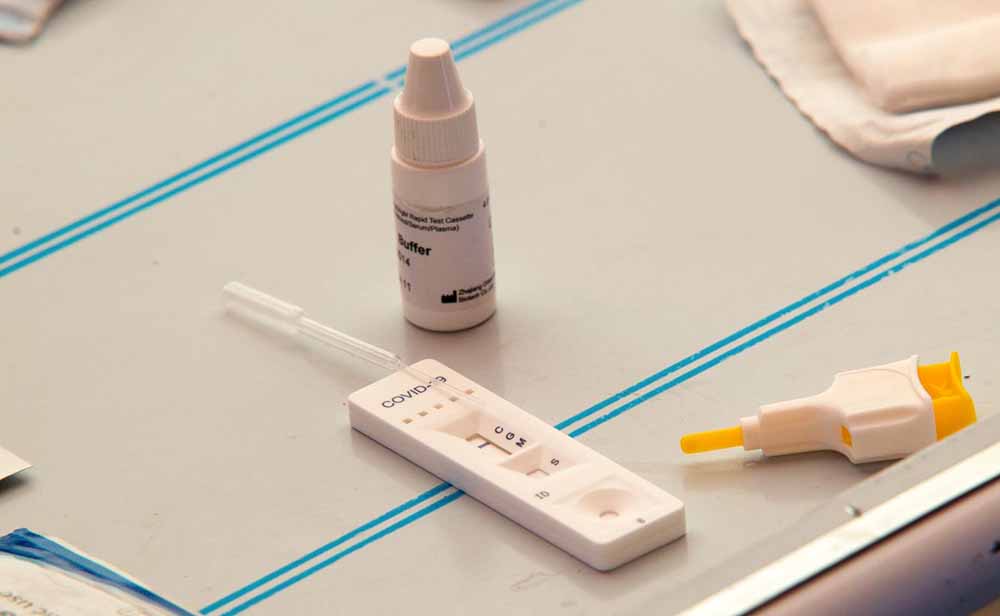 test rápidos para detección del coronavirus